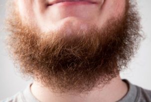 #NAME Why Do Some Men Find It Impossible To Grow  A Beard?