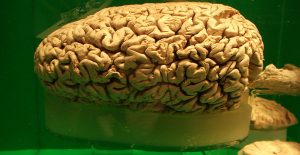 What animal has the largest brain