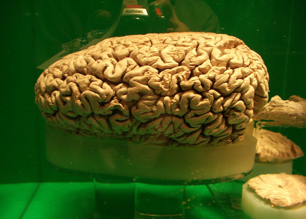 #NAME What animal has the largest brain?